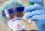 Министр здравоохранения Челябинской области заявил, что сдать анализ на коронавирус могут все желающие 